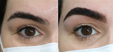 Brow lamination antes e depois e tudo sobre a técnica