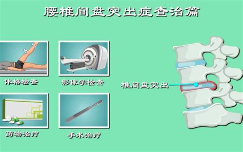 腰椎间盘突出查与治：推拿、按摩能治腰突？ 深读视频 深读视频 哔哩哔哩视频