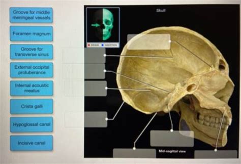 Solved Label The Specific Bony Features Of The Skull In Midsagittal View 1 Answer