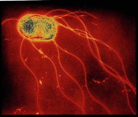 Salmonella Enteritidis Bacterium Photograph By A Dowsett Public