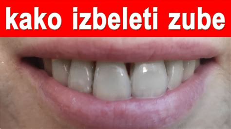 Kako Izbeliti Zube Youtube