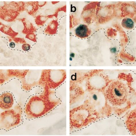 Rapid Insulitis And Diabetes In BDC2 5NOD Scid Mice A Insulitis Time