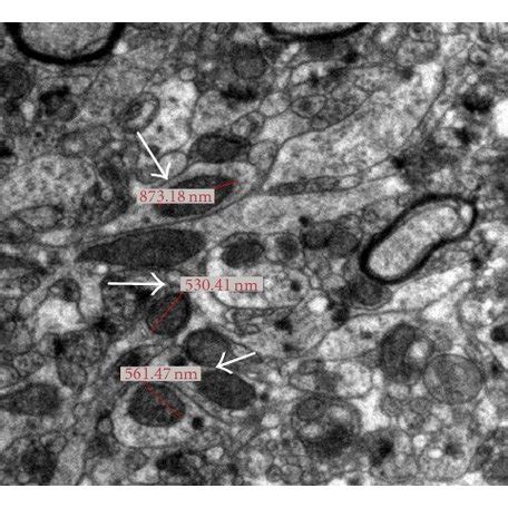 Transmission Electron Micrographs Of Sn Showing Ultrastructural Changes