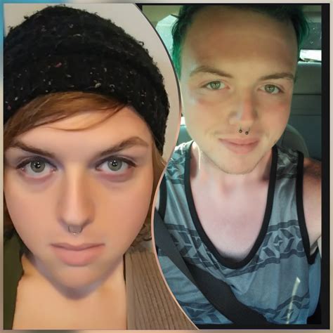 Right 6 Months Pre Hrt Left 4 Months Hrt R Transtimelines