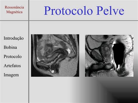 Protocolo Exame De Ressonancia Magnética Da Pelve