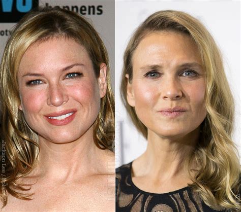 Renée Zellweger Then And Now Rpics