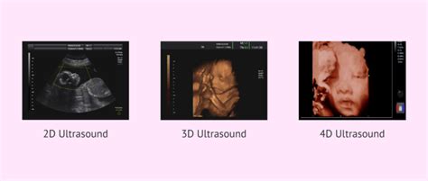 Differences in imaging between 2D, 3D and 4D ultrasound