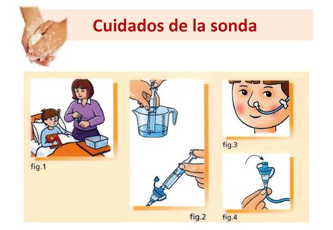 El Blog para las Cuidadoras Cuidados de la sonda nasogástica