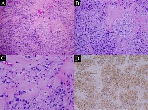 Hematoxylin And Eosin Hande Stained Sections Show Intermixed