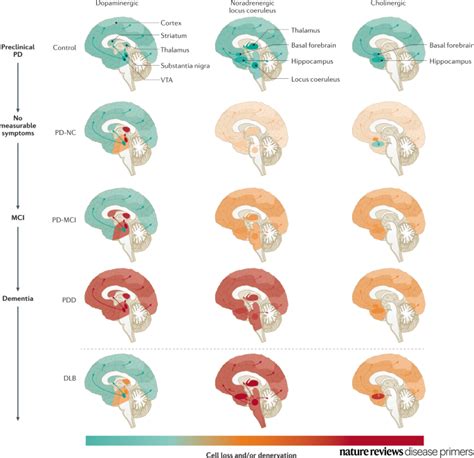 Nature Reviews Disease Primers On Twitter Defects In Several