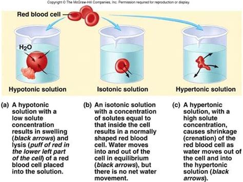 Hypertonic Hypotonic Isotonic Iv Solutions Hypertonic Hypotonic