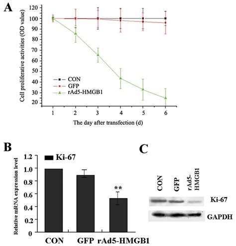 Expression And Clinical Significance Of HMGB1 In Human Liver Cancer