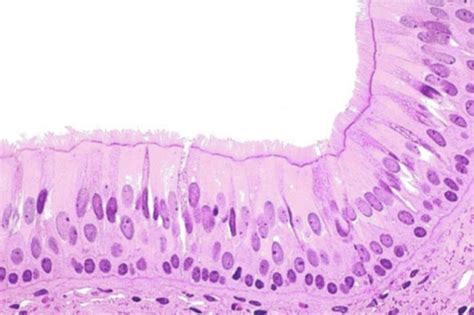 DSA6 7 Histo Lymphoid Tissue Lymphocytes LN Spleen Thymus Flashcards