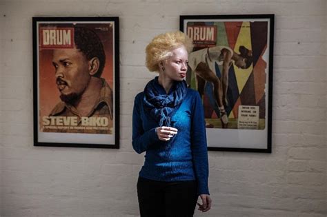 Photos South African Model Thando Hopa Revels In Her Albino Skin