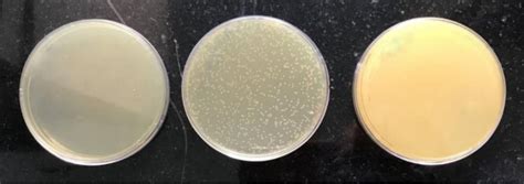 Bacterial Colony Forming Units Cfu Seen Brain Heart Infusion Media