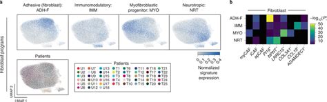 Molecular Stratification Of Cafs In Pdac A Expression Programs In Cafs Download Scientific