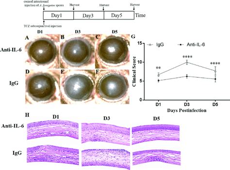 The Anti IL 6 Antibody Tocilizumab TCZ Suppresses The Pathological