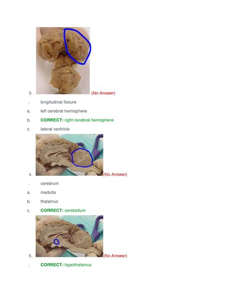 Solution Bsc Rasmussen Anatomy And Physiology Cns Quiz Studypool