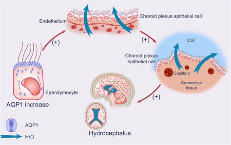 Frontiers The Pathogenesis Of Idiopathic Normal Pressure Hydrocephalus Based On The