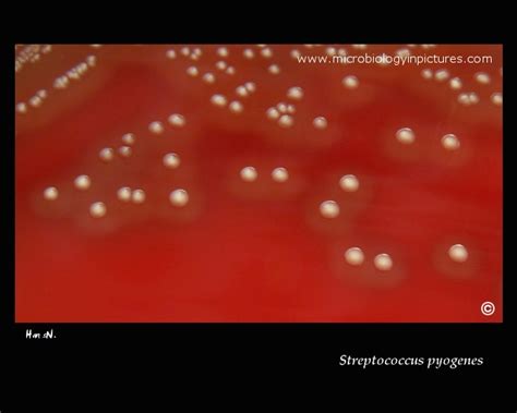 Group A Beta Hemolytic Streptococcus S Pyogenes Colony Appearance And