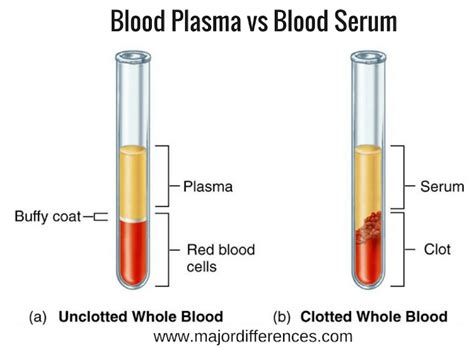 Difference between Blood serum and Blood plasma (Blood serum vs Blood plasma)