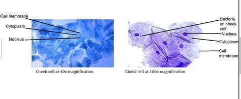 Cheek Cells Under Microscope Labeled