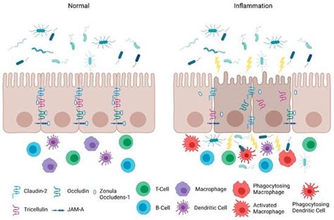 Intestinal Permeability Encyclopedia Mdpi