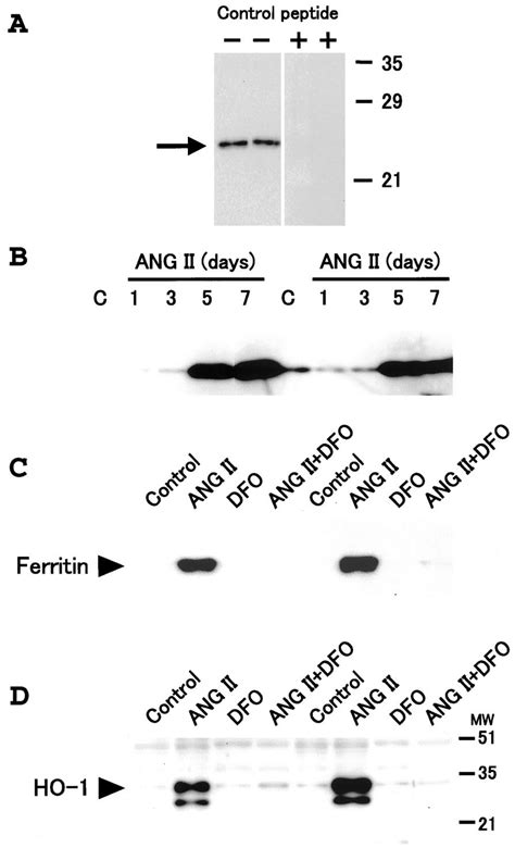 Effects of angiotensin II and the iron chelator, deferoxamine (DFO), on ...