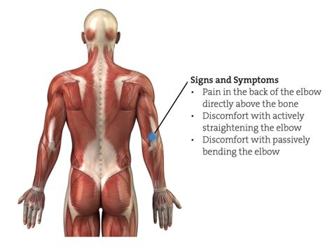 Triceps Tendinopathy – The Climbing Doctor