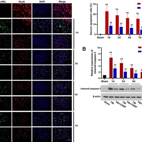 Cgrp Alleviated Brain Neuron Apoptosis After Tbi A Double Staining Of