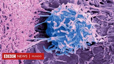 C Ncer El Misterio De Los Microbios Que Viven Dentro De Los Tumores