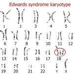 Patau Syndrome Karyotype Stock Vector Image By Zuzanaa