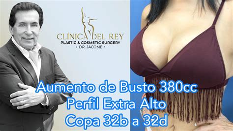 Meses Aumento De Busto Cc Perfil Extra Alto Cl Nica Del Rey