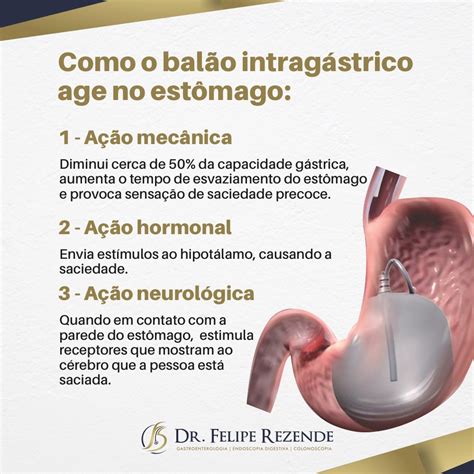 Dr Felipe Rezende Blog Bal O Intrag Strico Seu Aliado Seguro No