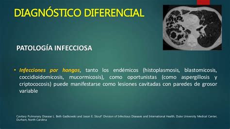 Lesiones Pulmonares Cavitadas