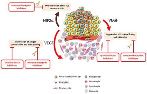 Tyrosine Kinase Inhibitors And Immunotherapy Combinations In Renal Cell