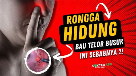 Awas Infeksi Bakteri Pada Hidung I Dr Dian Permana Angga P Youtube