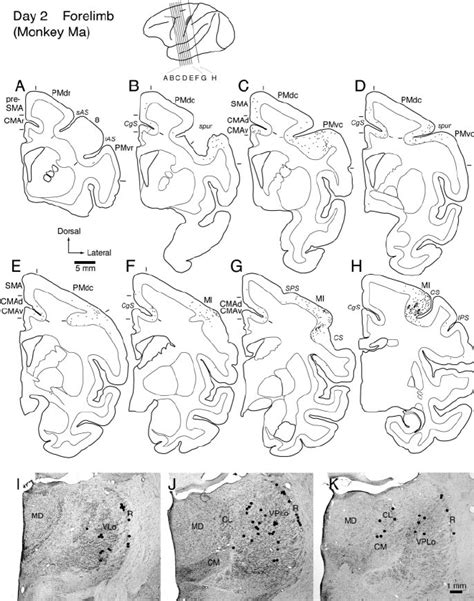 Distribution Patterns Of Retrograde Labeling In The Frontal Lobe A