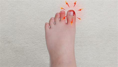 What Treatment Do Clinic Provide For Ingrown Toenail? | Mediumspot