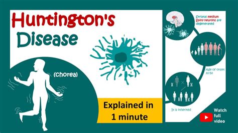 Huntington S Disease In Minute Minute Pathology Huntington S