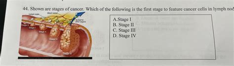 Solved Shown are stages of cancer. Which of the following is | Chegg.com