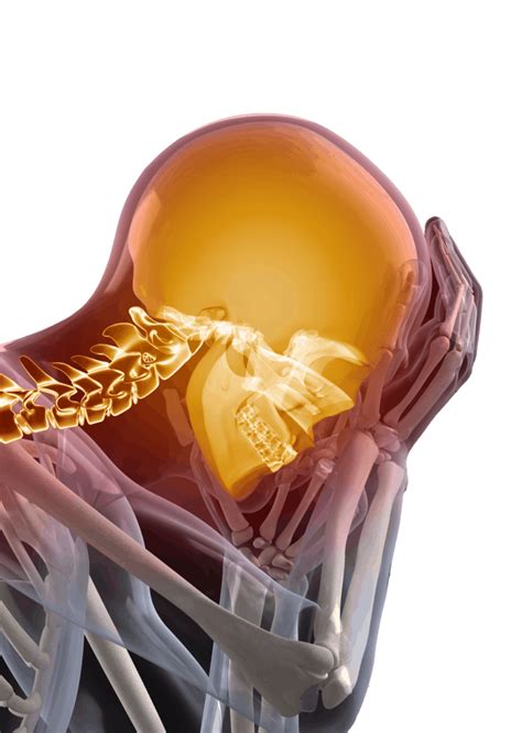 Temporomandibular Joints And Disorders Masters Orthodontics