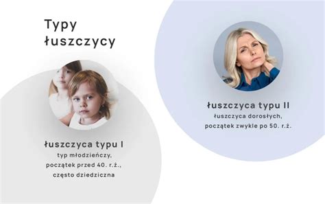 Uszczyca Objawy Diagnostyka Leczenie Alab Laboratoria