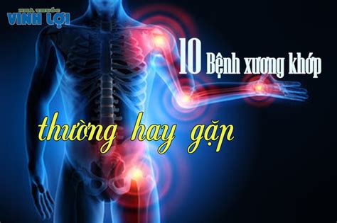 10 Bệnh cơ xương khớp thường gặp nhất hiện nay đặc biệt là người già