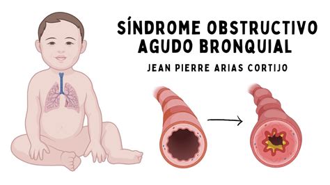 Síndrome obstructivo agudo bronquial SOBA bronquiolitis YouTube