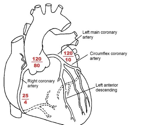 Acute Right Heart Failure Rcemlearning