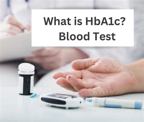 Hba1c Test A Smart Means To Map Glucose Level In The Body 43 Off