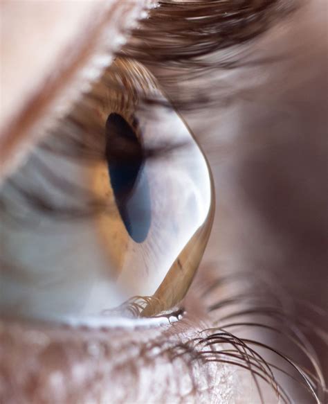 Eyelash Loss And Short Eyelashes Treatment Face Restoration