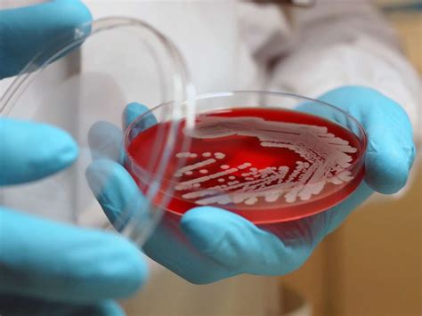 Superbugs: What they are, evolution, and what to do