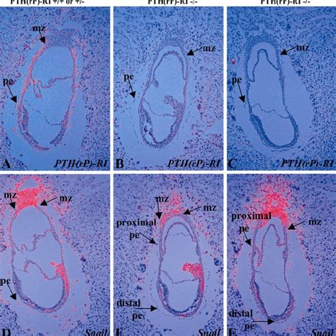 Expression Of Sna Mrna In E Wild Type And Pth Rp Ri Mouse